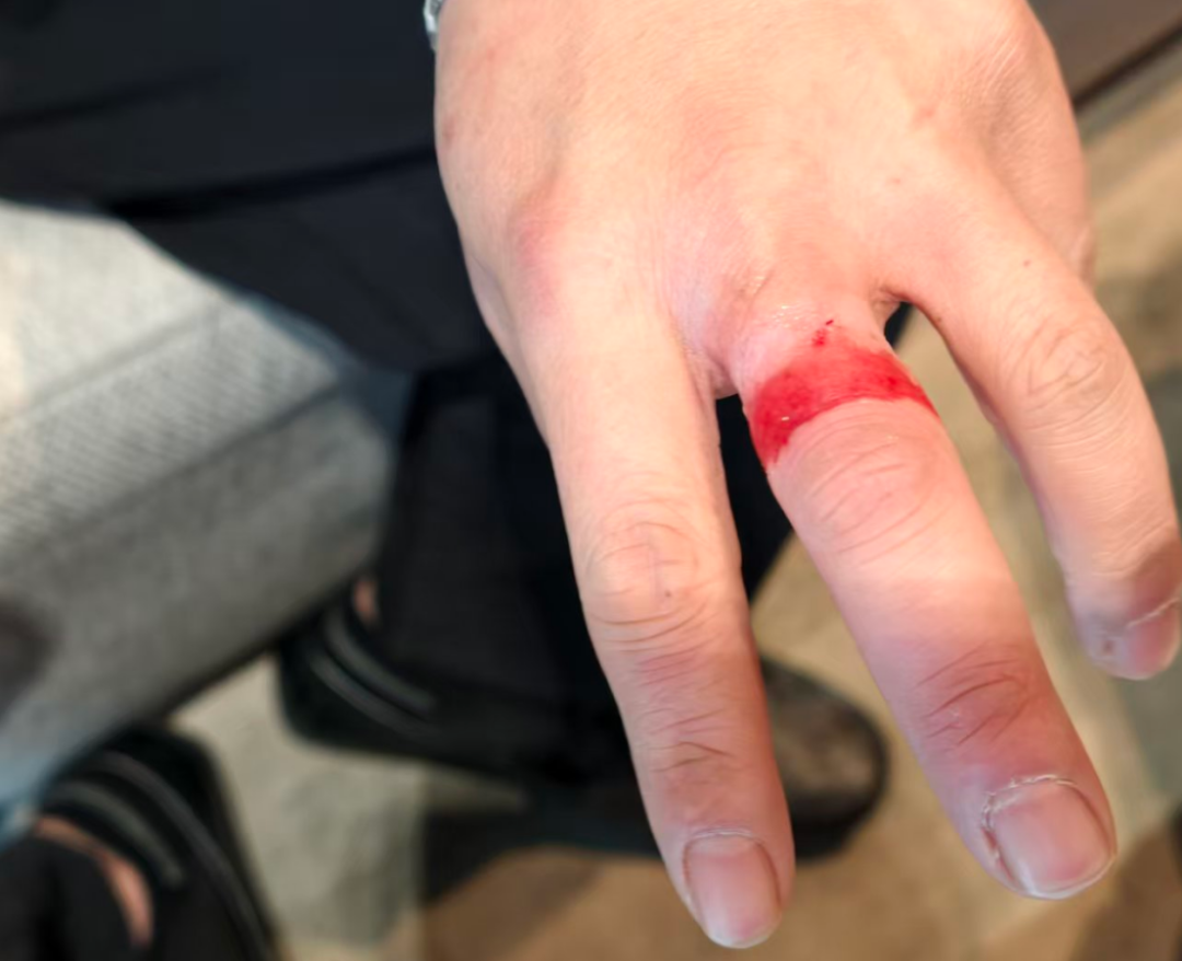 640?wx_fmt=png&from=appmsg#imgIndex=5